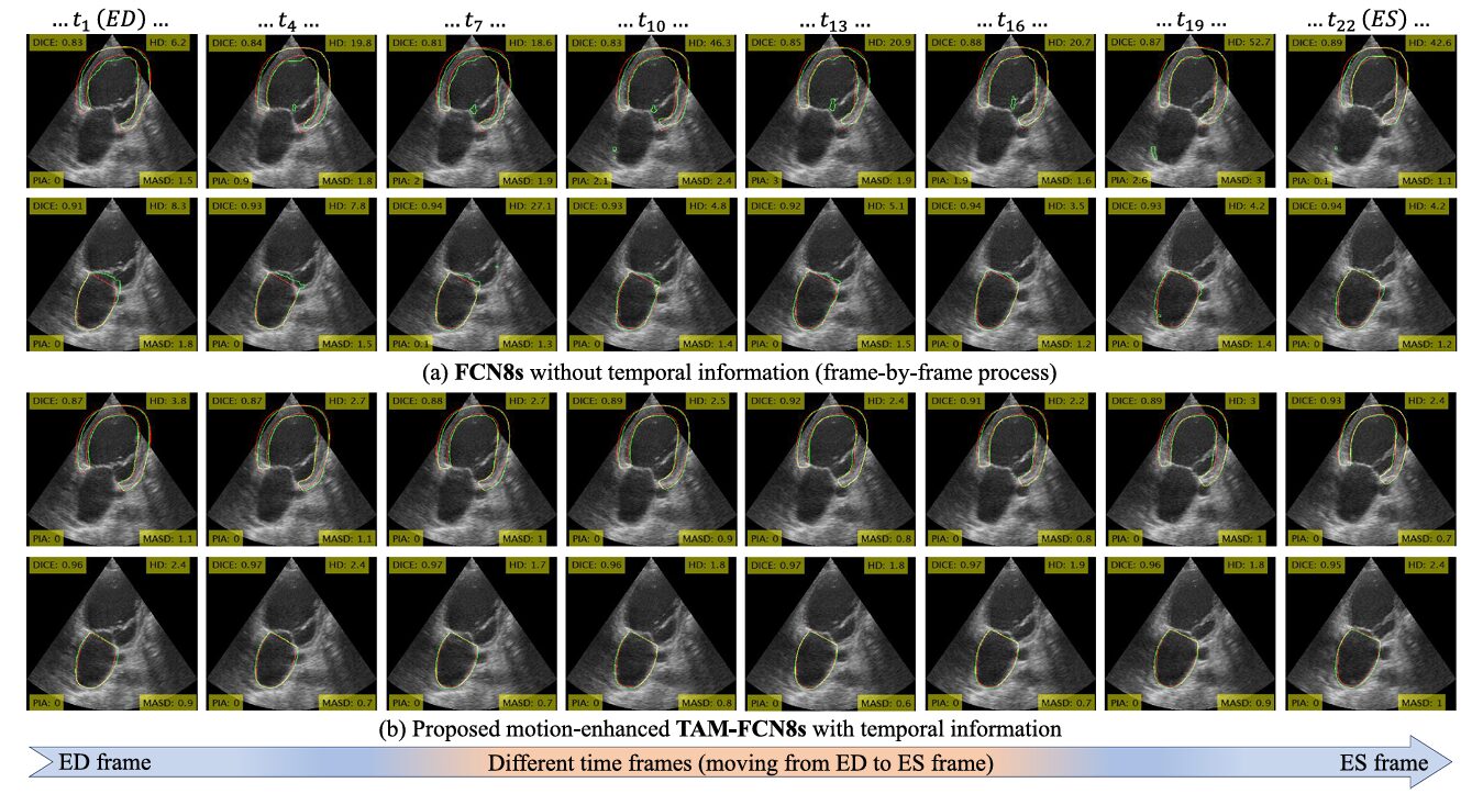 Structural Causal Model diagram showing nodes S, U, F, X, Y, E