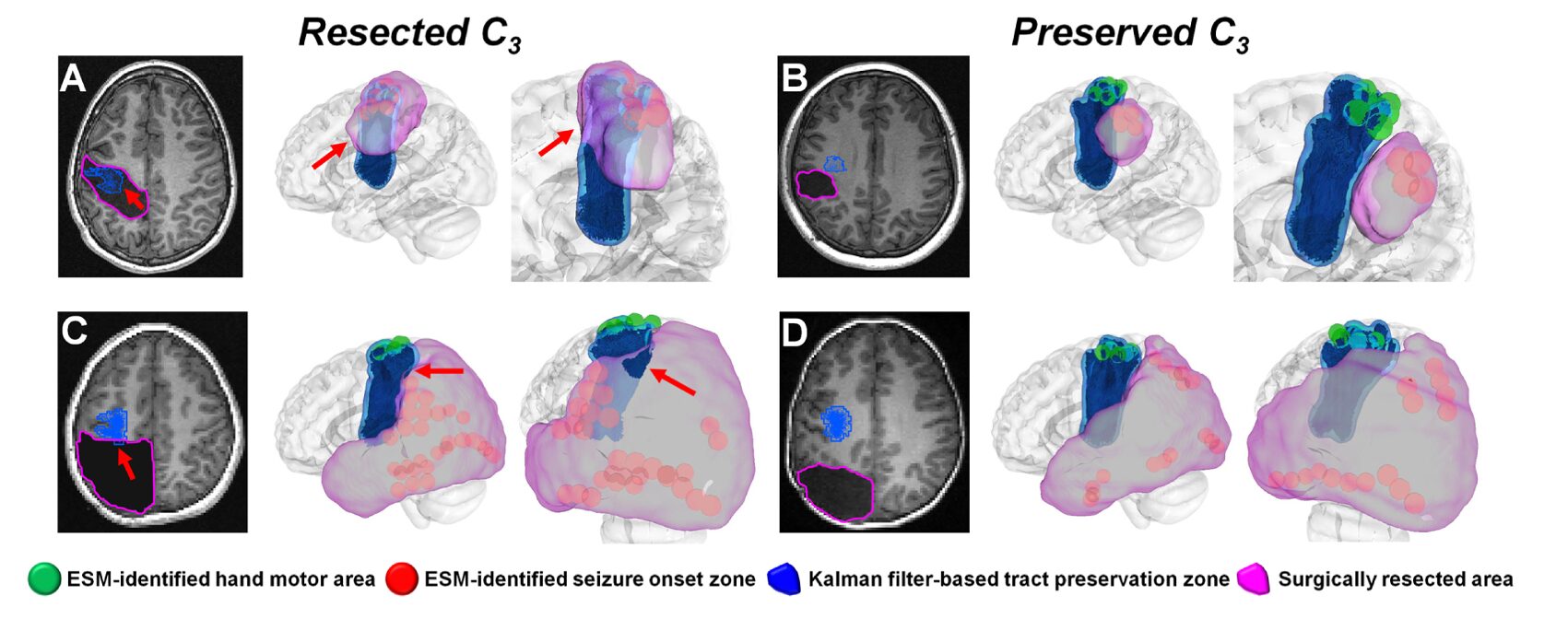 Structural Causal Model diagram showing nodes S, U, F, X, Y, E