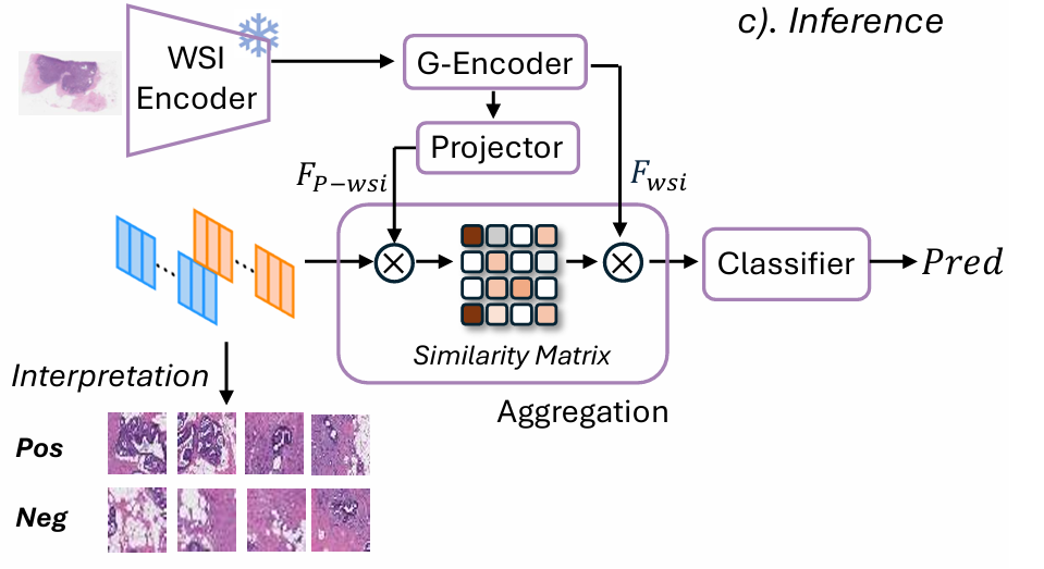 Breast cancer histology slide showing tissue microarchitecture