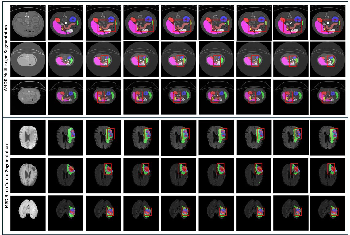 Structural Causal Model diagram showing nodes S, U, F, X, Y, E