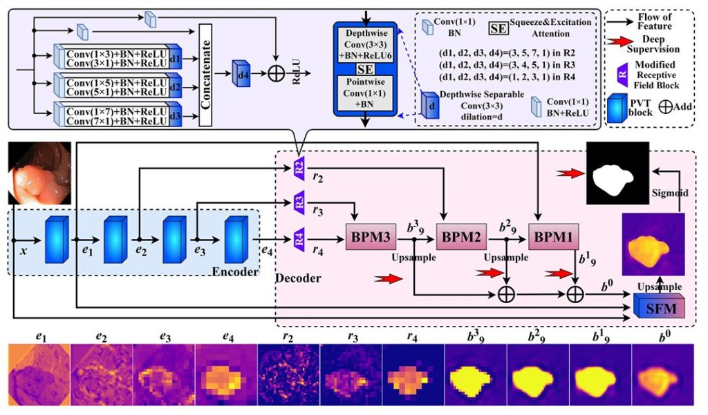 MSBP-Net: The Lightweight Polyp Detector.