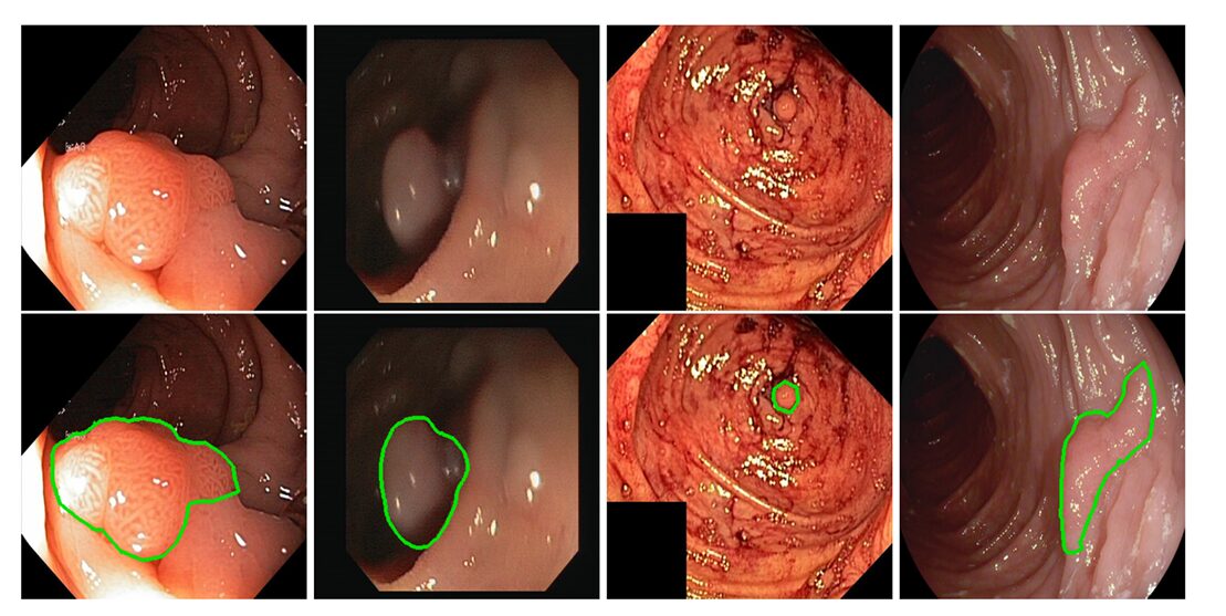 Structural Causal Model diagram showing nodes S, U, F, X, Y, E