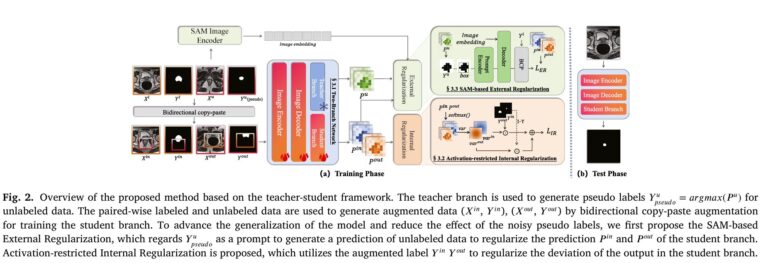 IERE: SAM-Powered Cross-Domain Medical Image Segmentation Without Inference Cost