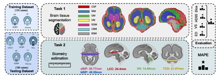 FeTA 2024: What 16 Teams Scanning Unborn Brains Taught Us About the Limits of AI Segmentation