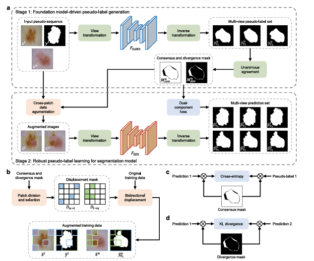 YoloSeg: One Labeled Image Is All You Need for Medical Image Segmentation.