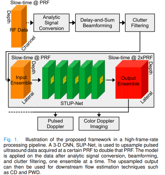 SUP-Net: Deep Learning Fixes Doppler Ultrasound Aliasing by Upsampling the Raw Signal