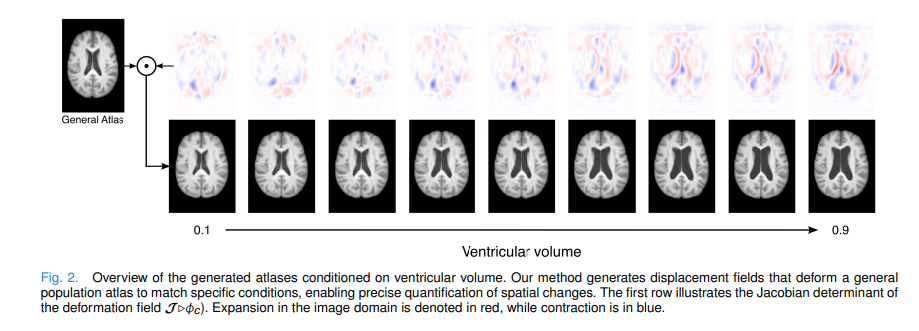 Diff-Def: Diffusion-Generated Deformation Fields for Conditional Brain Atlases