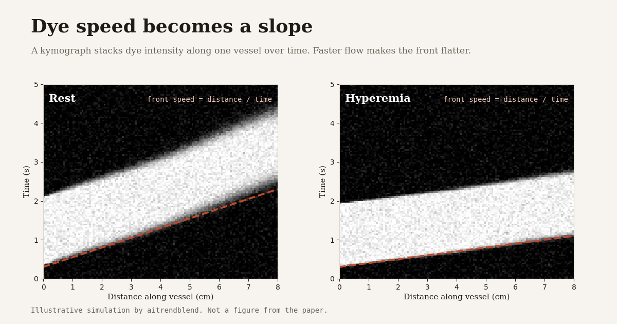 Two simulated kymographs of contrast dye moving along a coronary artery, one at rest and one during hyperemia, where the faster hyperemic flow makes the dye front flatter, illustrating how PUNCH estimates coronary flow reserve from angiography